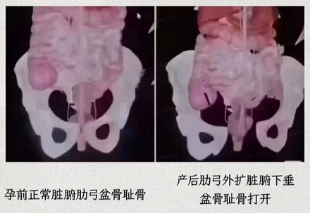 为啥欧美孕妇产后恢复的速度更快一点？